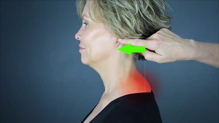 Correcting Forward Head Posture: Relieve Pain and Headaches