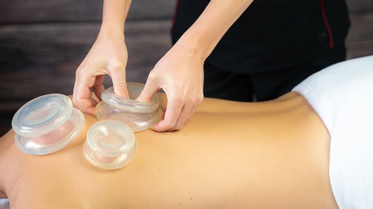 Master Myofascial Cupping