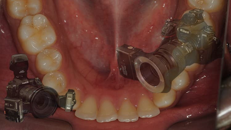 Learn Clinical Photography in Dentistry