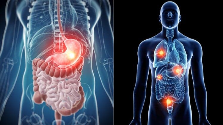 The way of Chinese Medicine for Oncology care