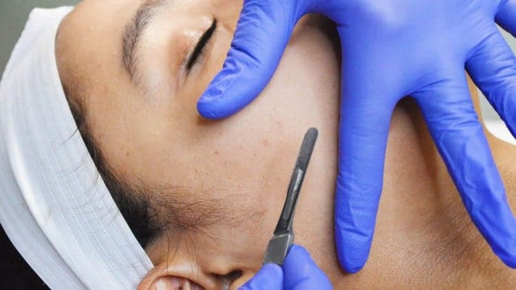 The Ultimate Guide to Performing a Dermaplaning Facial